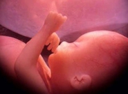 13_aborto1.jpg